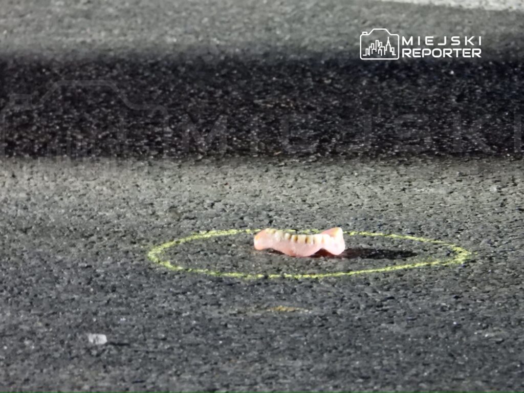 Na asfaltowej nawierzchni leży różowa proteza zębowa, otoczona żółtym okręgiem.