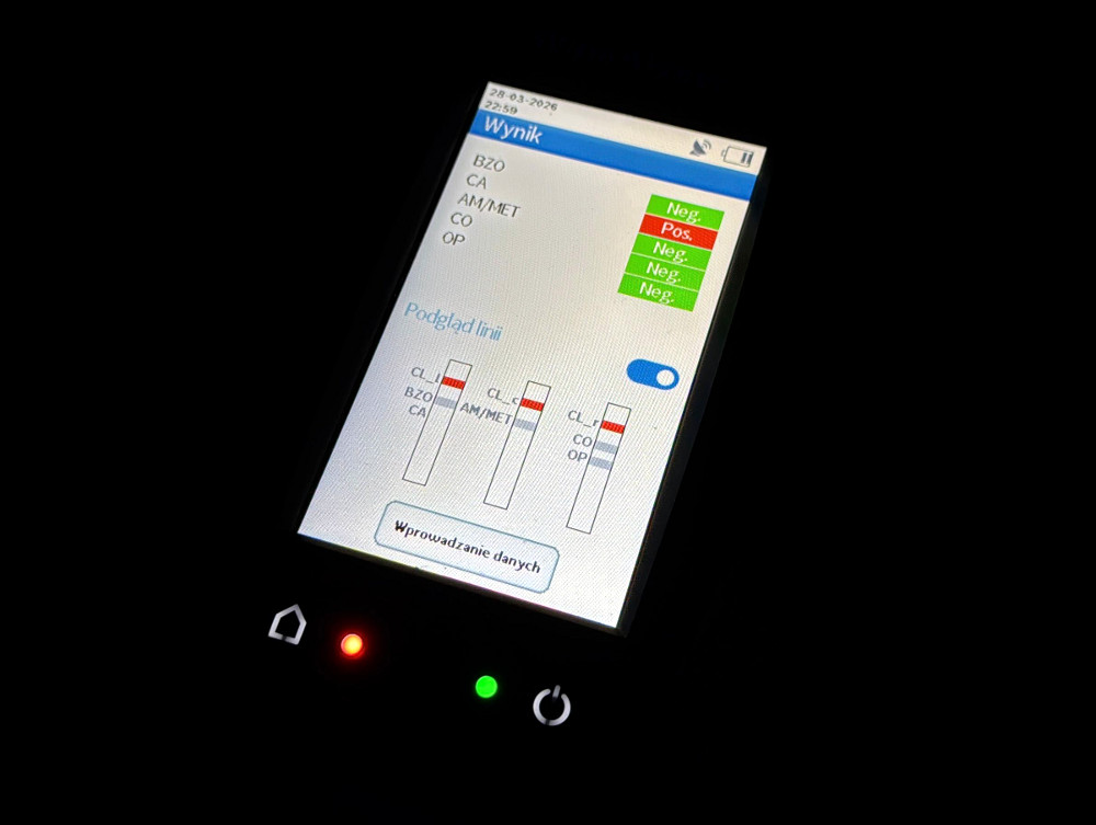 Ekran urządzenia medycznego z wynikami badań, wyświetlający wartości i statusy: BZO, CA, AM/MET, CO oraz OP.