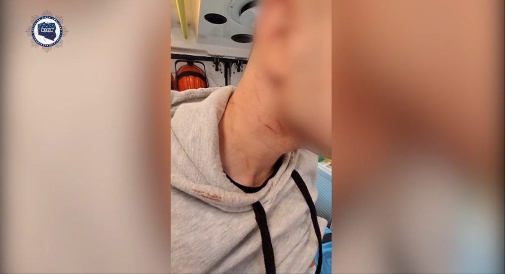 Mężczyzna w szarej bluzie z widocznymi zadrapaniami na szyi siedzi w ambulansie.