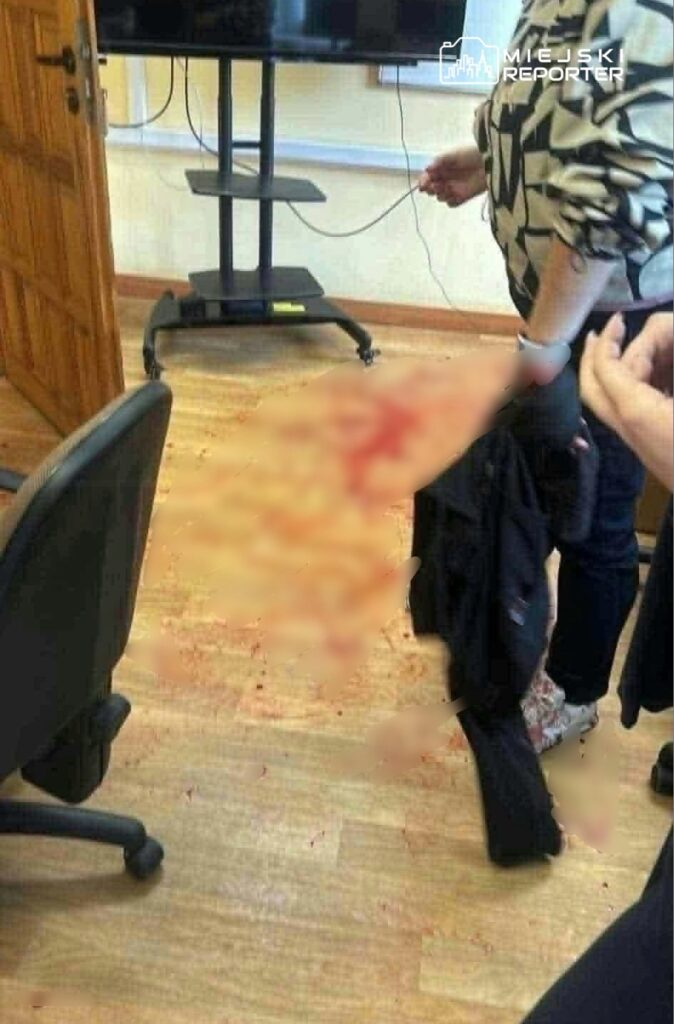 Osoba w patterned bluzce stoi przy zakrwawionej nodze drugiej osoby w pomieszczeniu z krzesłami i ekranem.